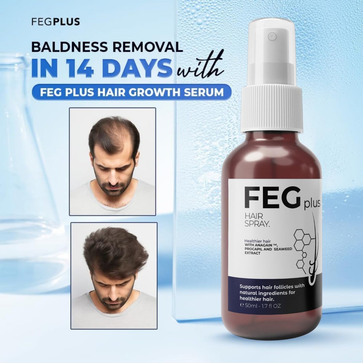 FEG Plus Hair Growth Spray | Anti-Hair Loss & Regrowth Solution