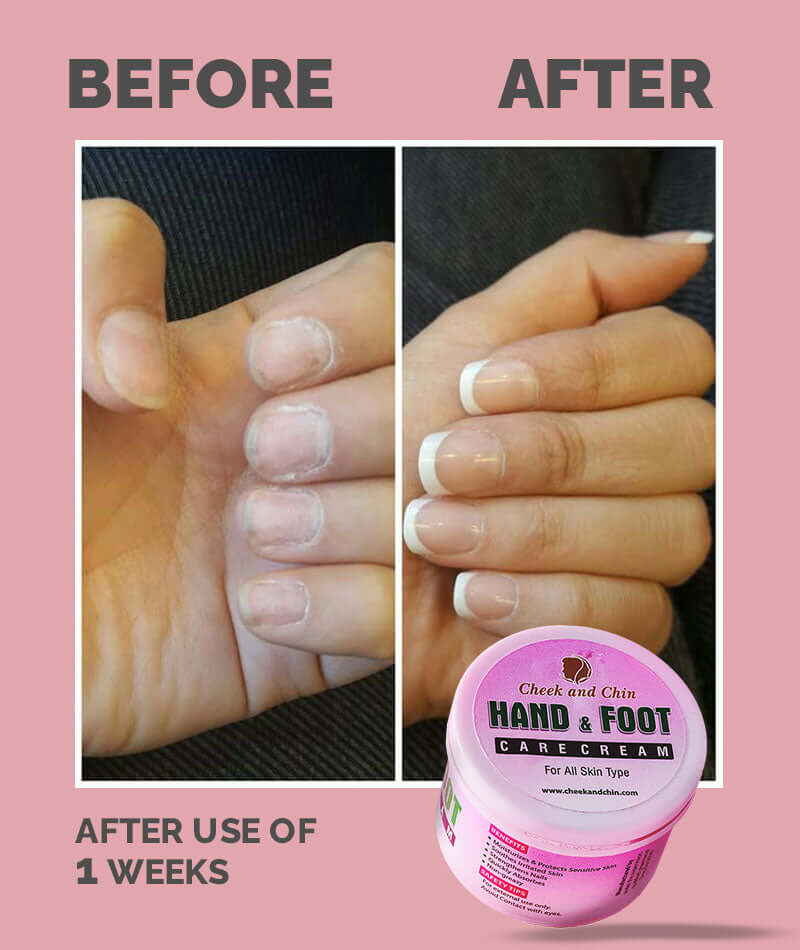 Hand & Foot Care Cream | Strong Whitening Moisturizer with Aloe Vera Shea & Cocoa Butter for All Skin Types