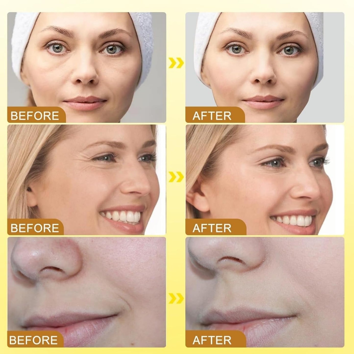 Botox Bee Venom Wrinkle Cream | Anti-Aging & Collagen Boosting Moisturizer