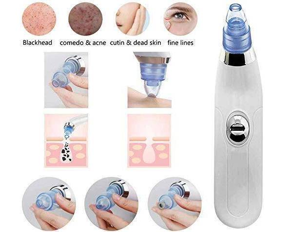 Derma Suction 3 In 1 Black Head Remover Machine | Acne, Pimple, Pore Cleaner Vacuum Suction Tool